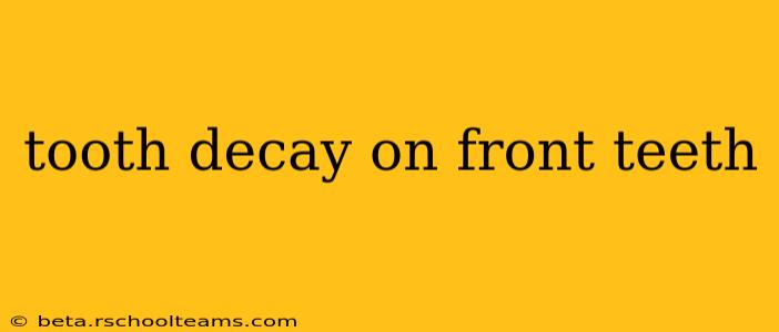 tooth decay on front teeth