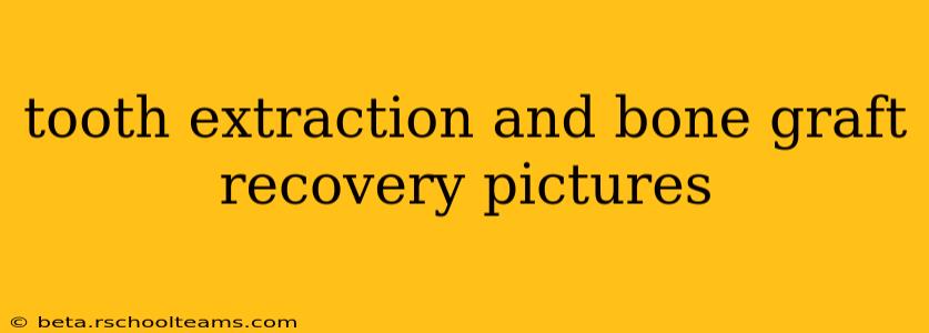tooth extraction and bone graft recovery pictures