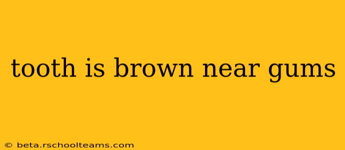 tooth is brown near gums