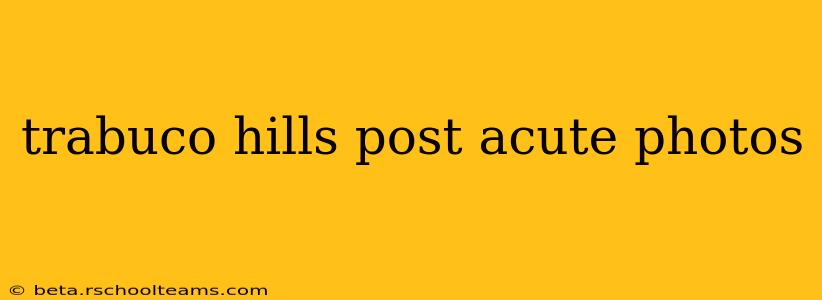 trabuco hills post acute photos