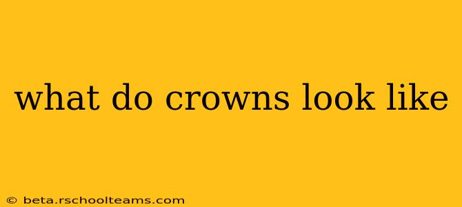what do crowns look like