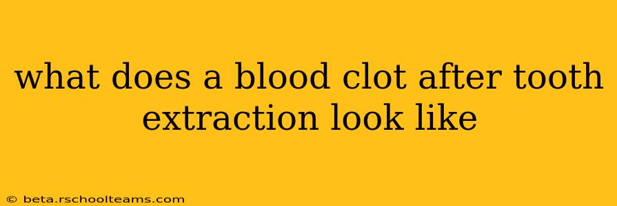 what does a blood clot after tooth extraction look like
