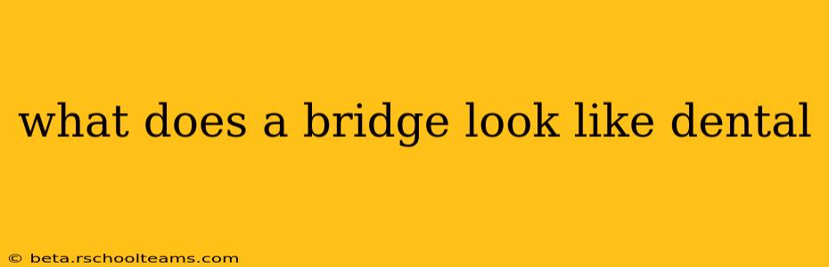 what does a bridge look like dental