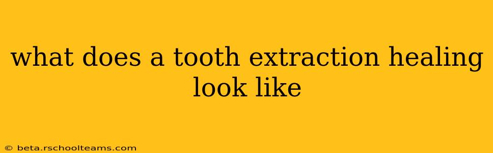 what does a tooth extraction healing look like