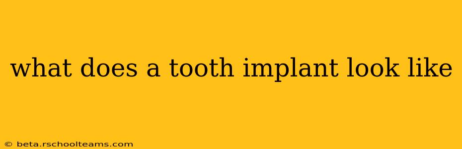 what does a tooth implant look like