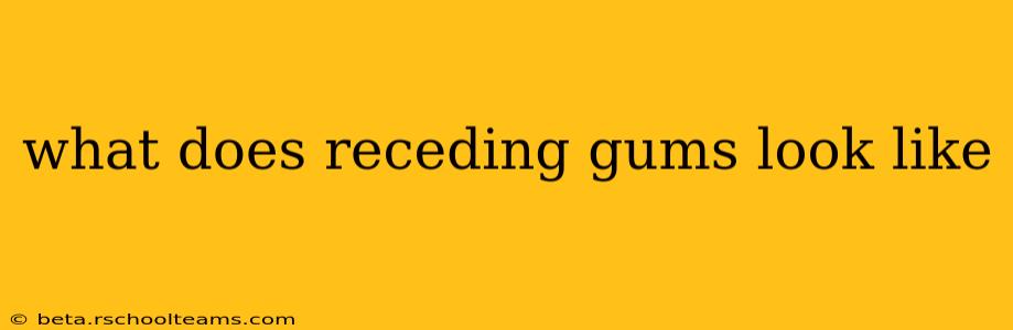 what does receding gums look like