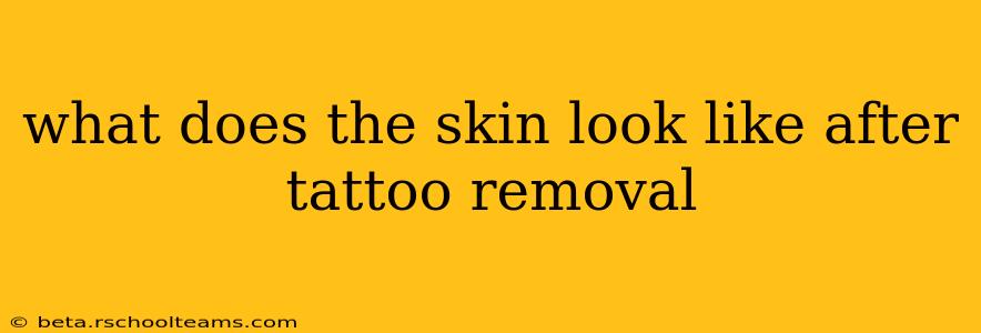 what does the skin look like after tattoo removal