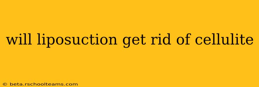 will liposuction get rid of cellulite