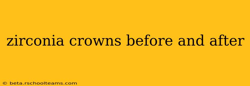 zirconia crowns before and after