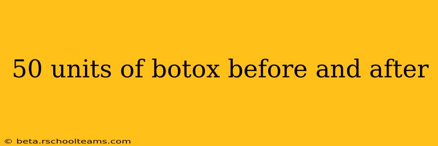 50 units of botox before and after
