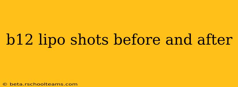 b12 lipo shots before and after