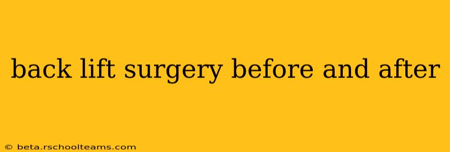 back lift surgery before and after