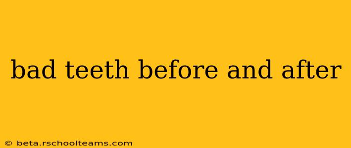 bad teeth before and after