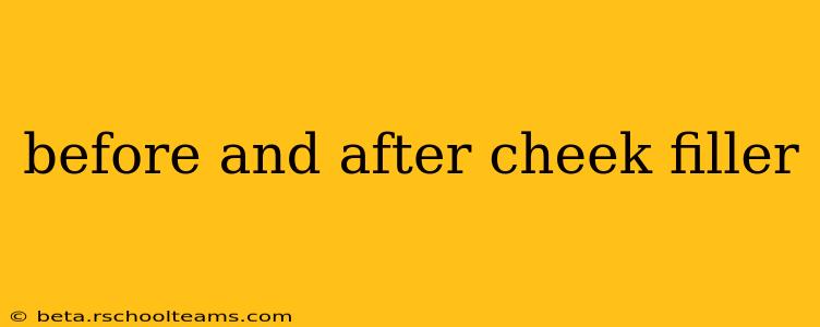 before and after cheek filler