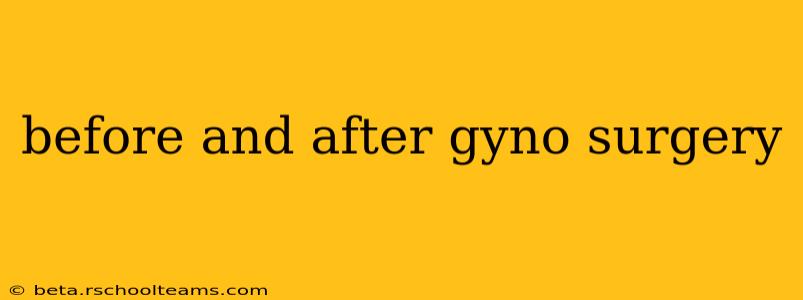 before and after gyno surgery