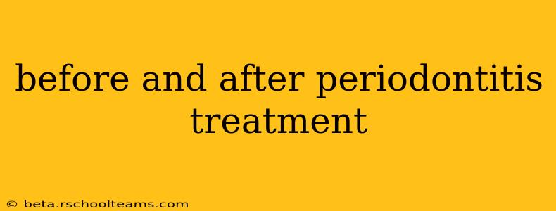before and after periodontitis treatment