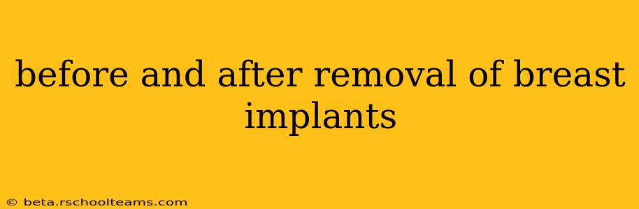 before and after removal of breast implants