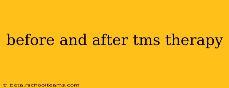 before and after tms therapy
