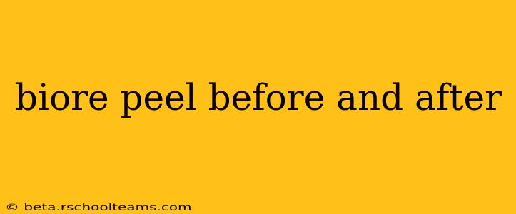 biore peel before and after