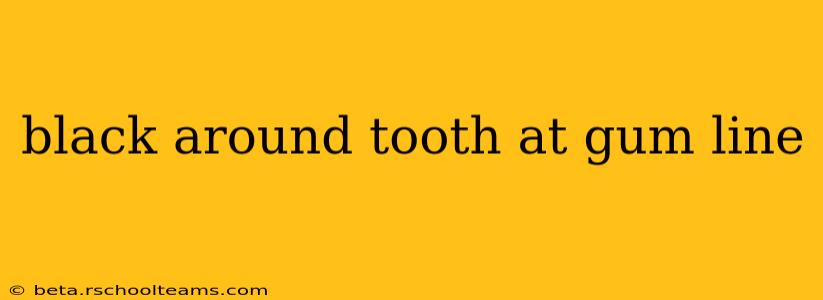 black around tooth at gum line