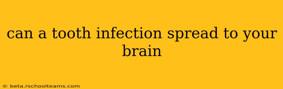 can a tooth infection spread to your brain