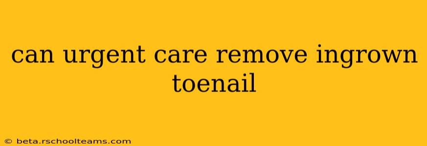 can urgent care remove ingrown toenail