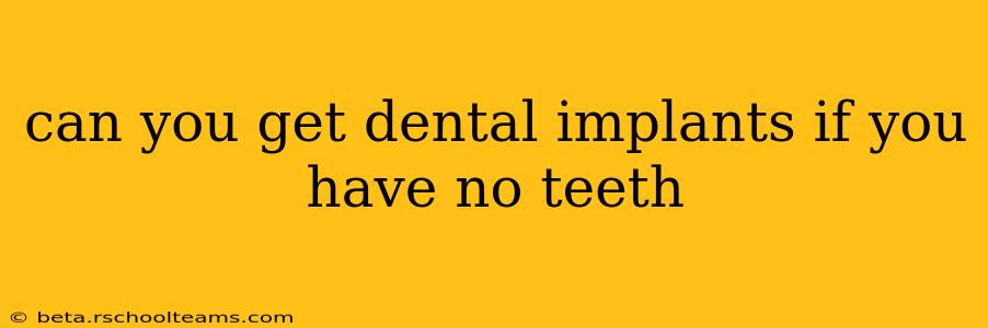can you get dental implants if you have no teeth