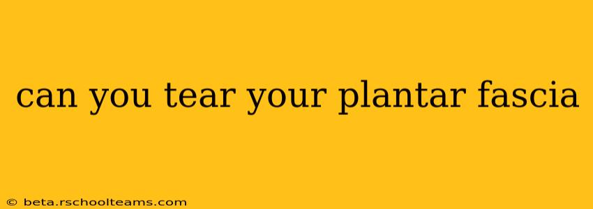 can you tear your plantar fascia