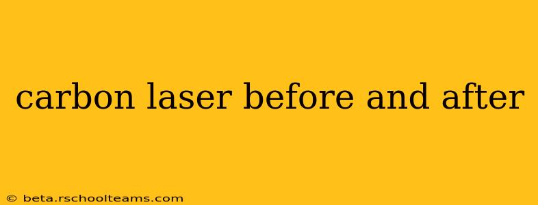 carbon laser before and after