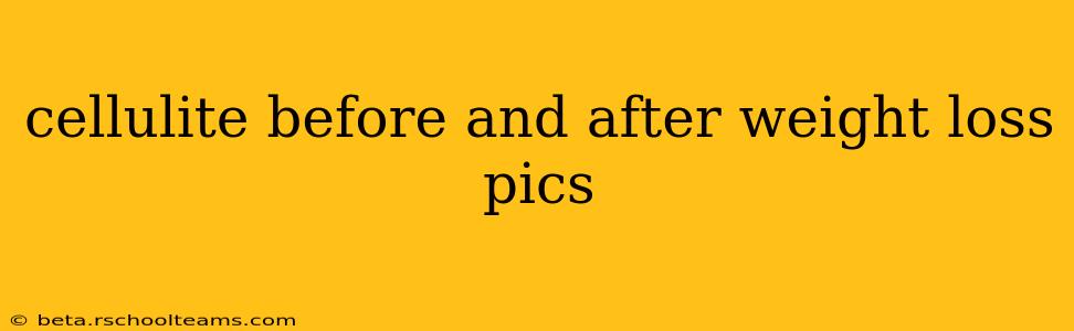 cellulite before and after weight loss pics