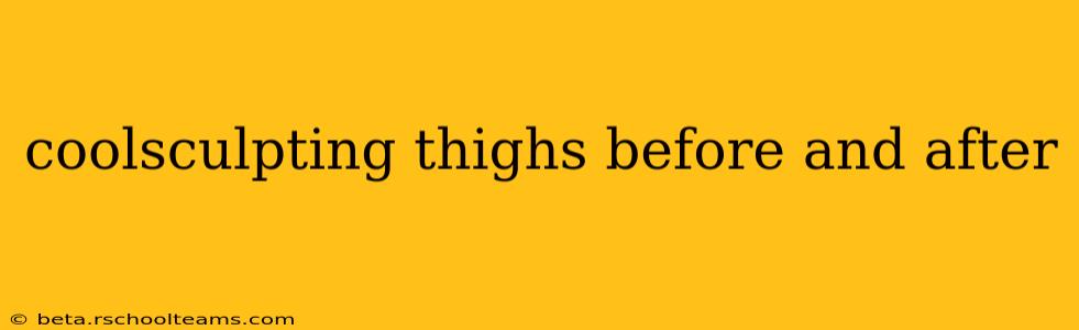 coolsculpting thighs before and after