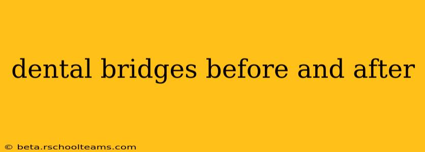 dental bridges before and after
