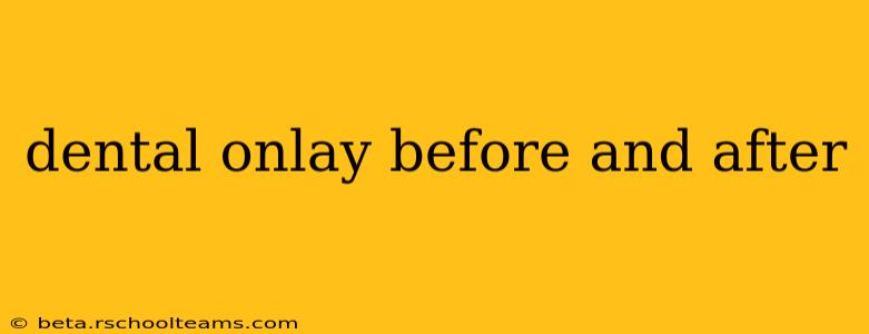 dental onlay before and after