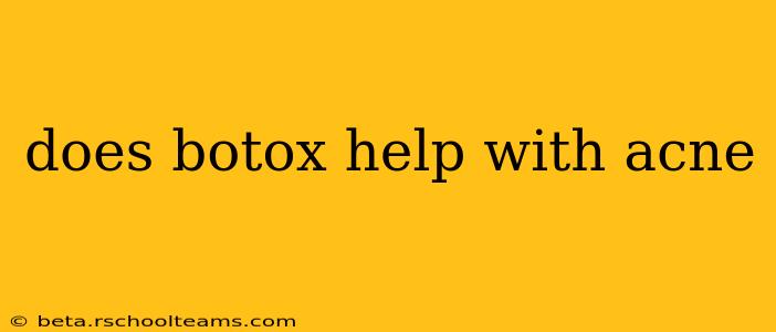 does botox help with acne