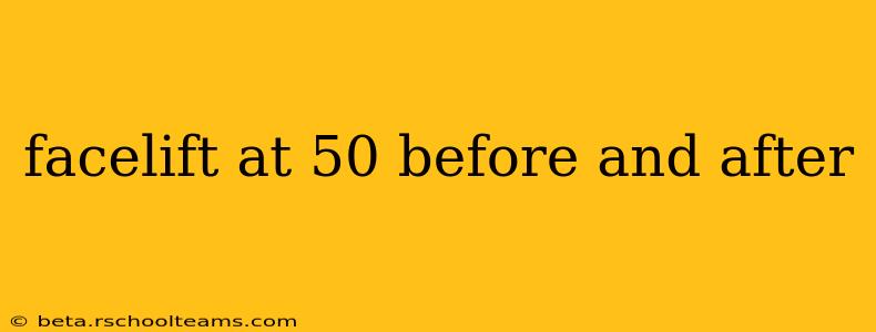 facelift at 50 before and after