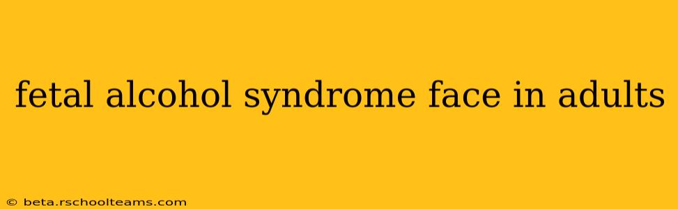 fetal alcohol syndrome face in adults