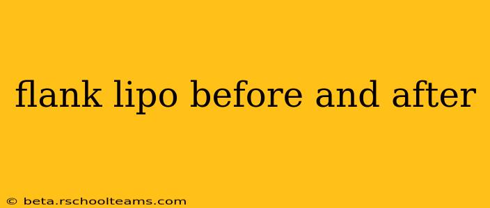 flank lipo before and after