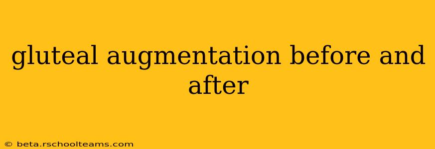 gluteal augmentation before and after