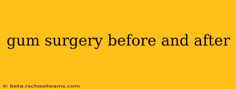 gum surgery before and after