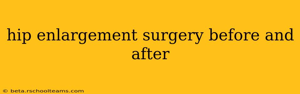 hip enlargement surgery before and after