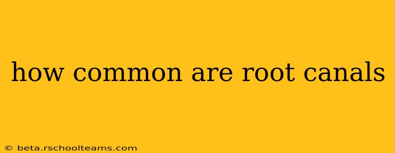 how common are root canals