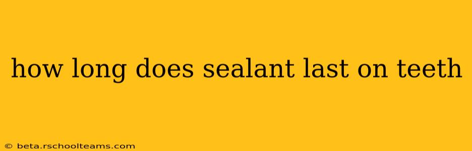 how long does sealant last on teeth