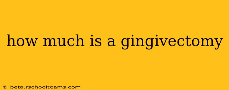 how much is a gingivectomy