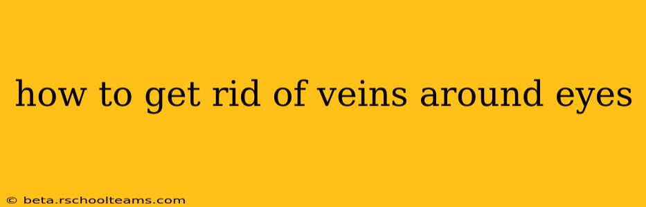 how to get rid of veins around eyes