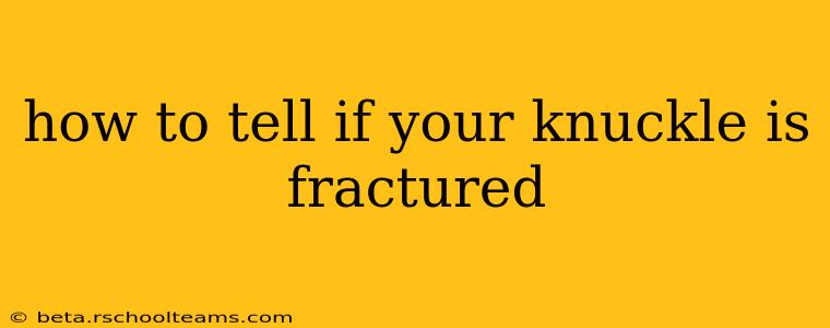 how to tell if your knuckle is fractured
