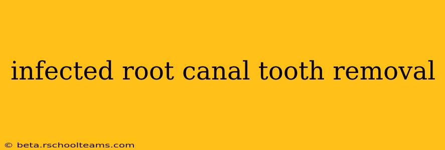 infected root canal tooth removal