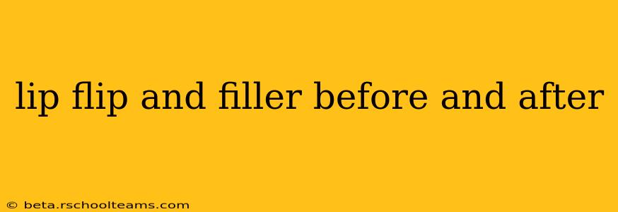 lip flip and filler before and after