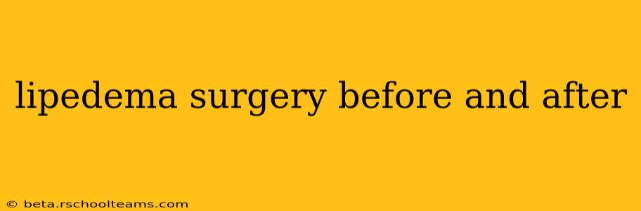 lipedema surgery before and after