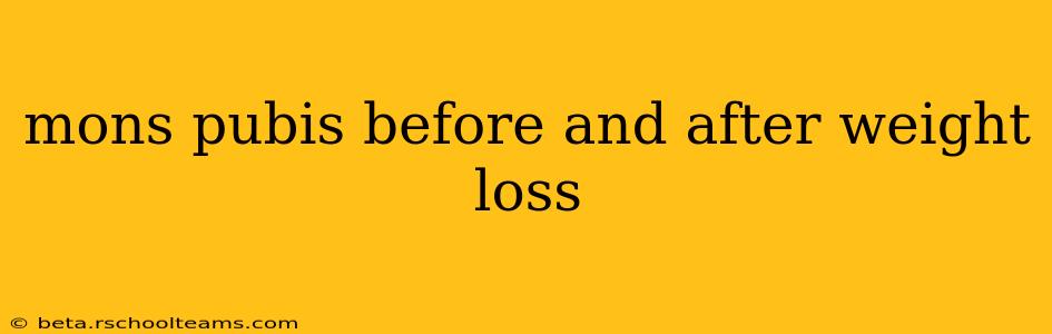 mons pubis before and after weight loss