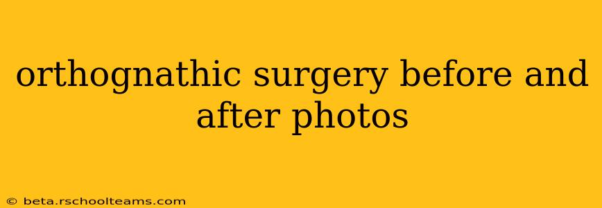 orthognathic surgery before and after photos